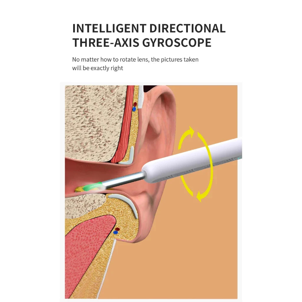 Limpador de Ouvido Inteligente NE3